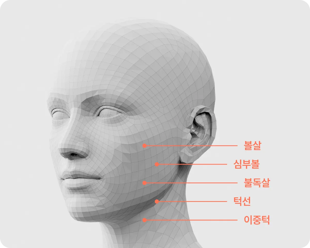 시술 부위 설명 사진