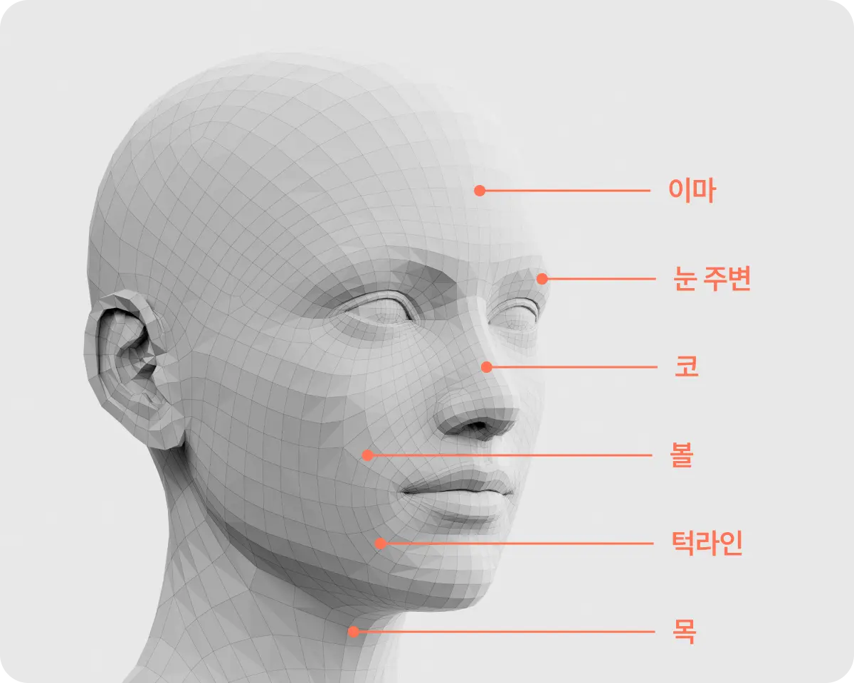 시술 부위 설명 사진
