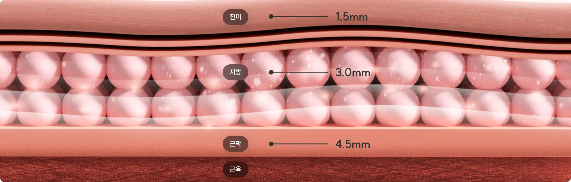 시술 장점 설명 이미지 2