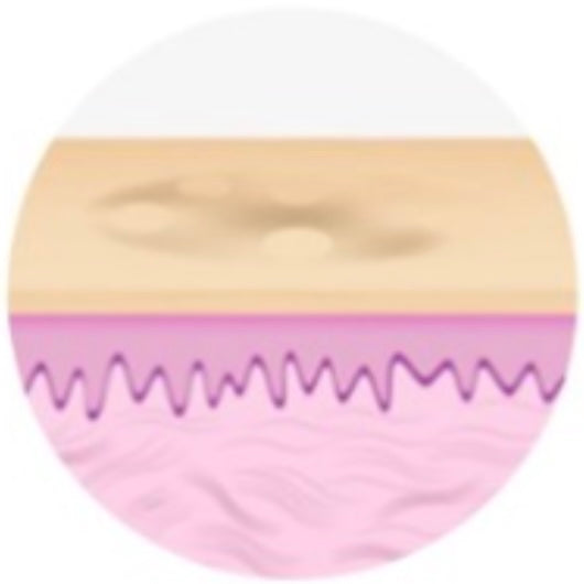 스킨 보톡스 시술 부위 설명 이미지 3