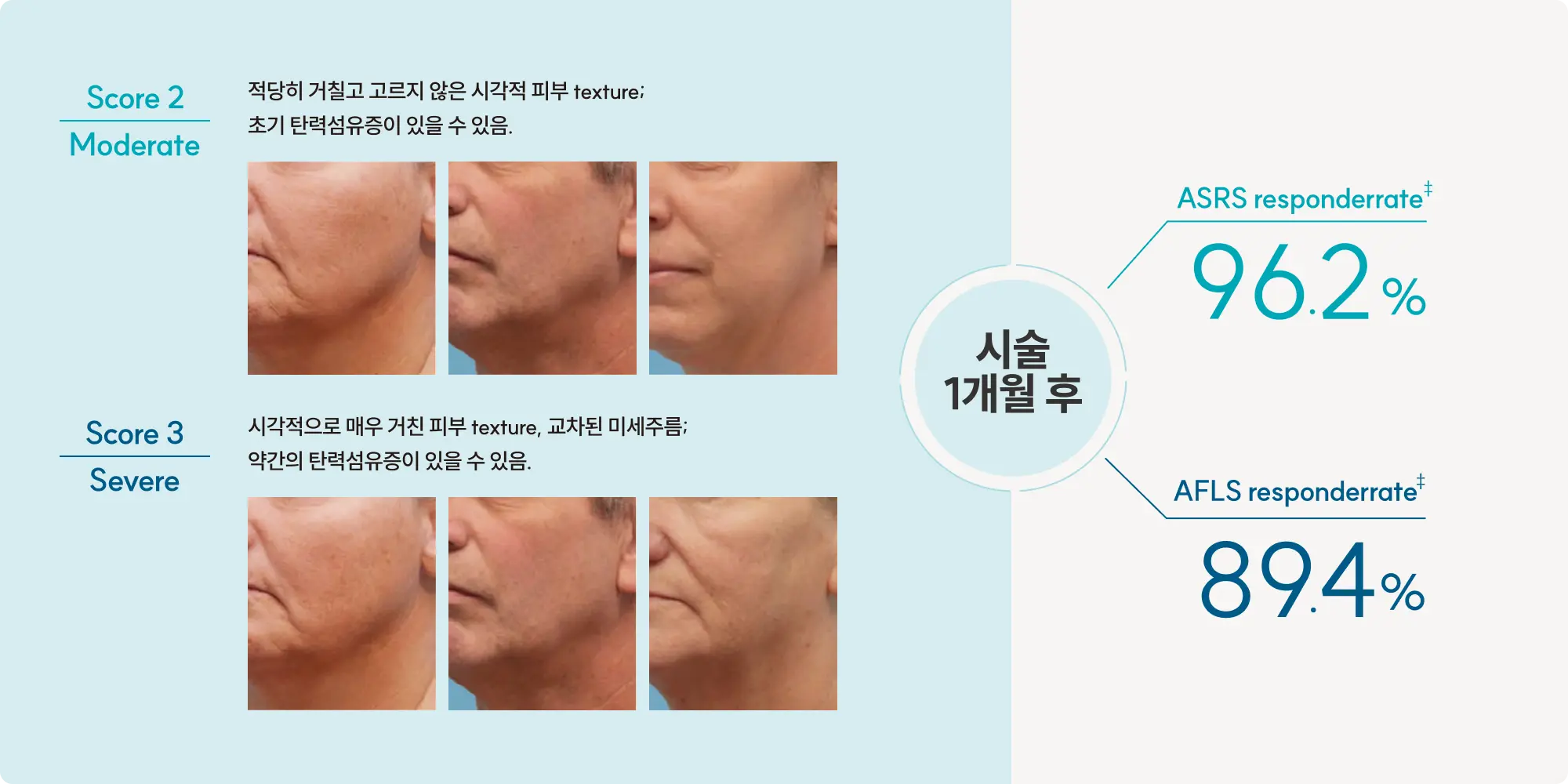 시술 장점 설명 이미지 2