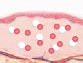 스킨 보톡스 시술 부위 설명 이미지 2