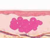 스킨 보톡스 시술 부위 설명 이미지 4