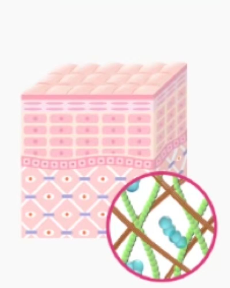 스킨 보톡스 시술 부위 설명 이미지 3