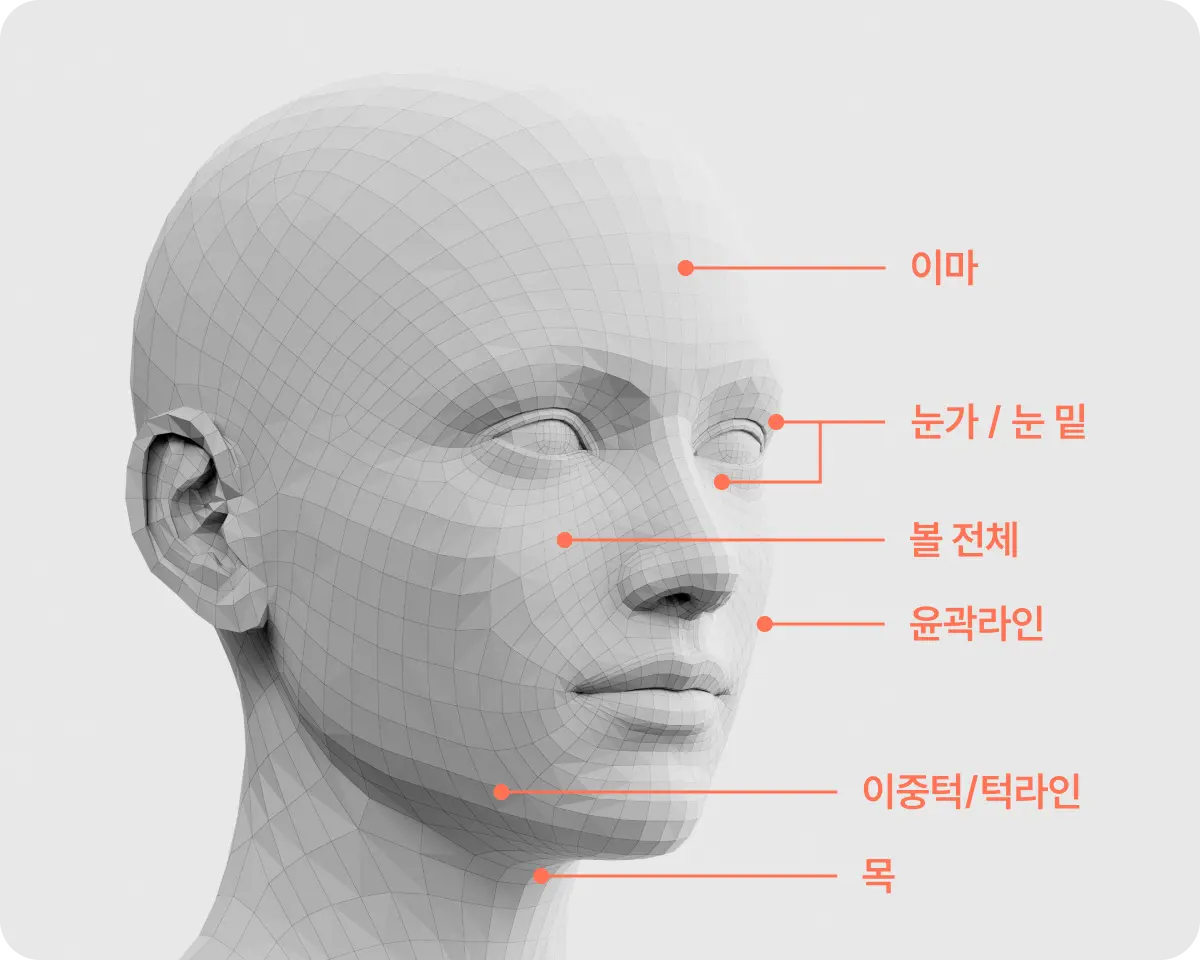 시술 부위 설명 사진