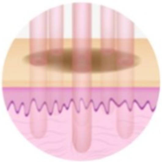 스킨 보톡스 시술 부위 설명 이미지 1