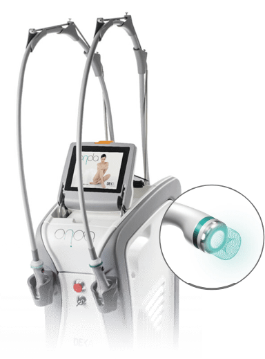 Illustration of the eye showing how LASIK surgery corrects vision