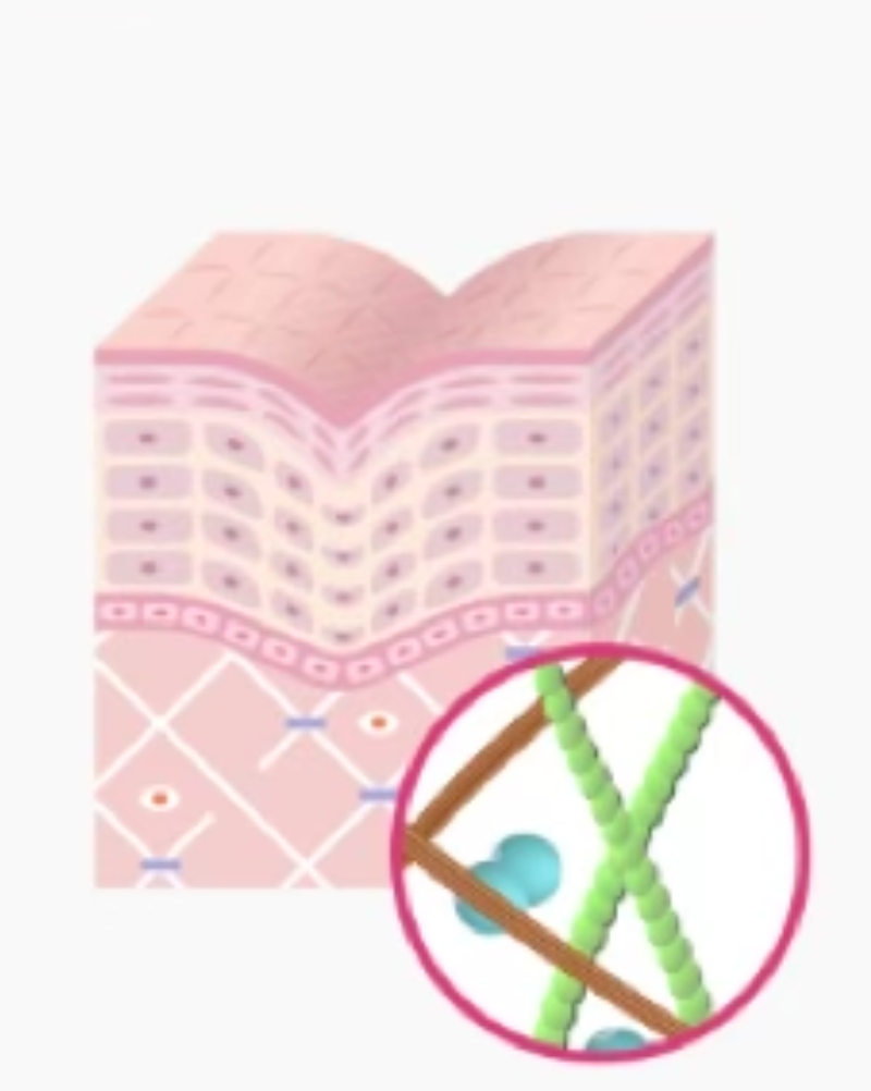 스킨 보톡스 시술 부위 설명 이미지 2