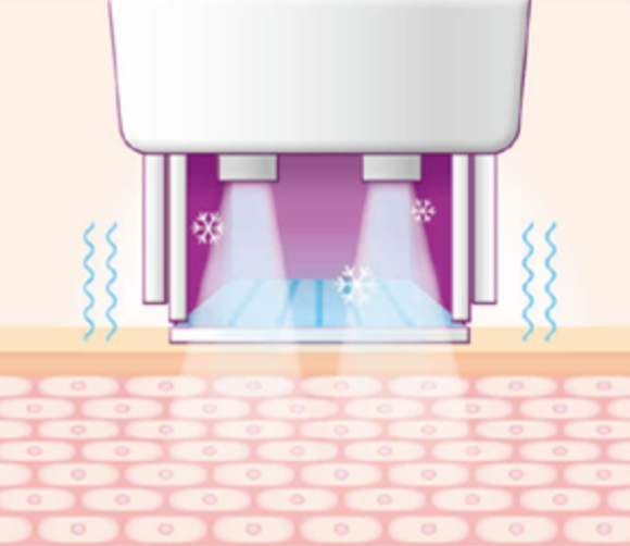 스킨 보톡스 시술 부위 설명 이미지 2