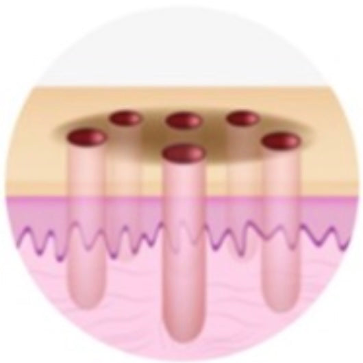 스킨 보톡스 시술 부위 설명 이미지 2