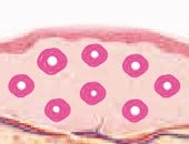 스킨 보톡스 시술 부위 설명 이미지 3