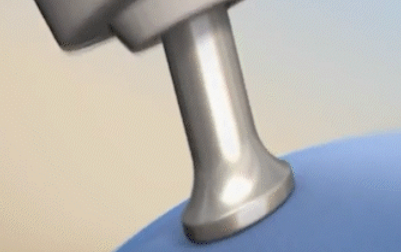 스킨 보톡스 시술 부위 설명 이미지 3