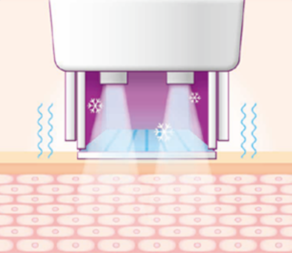 스킨 보톡스 시술 부위 설명 이미지 1