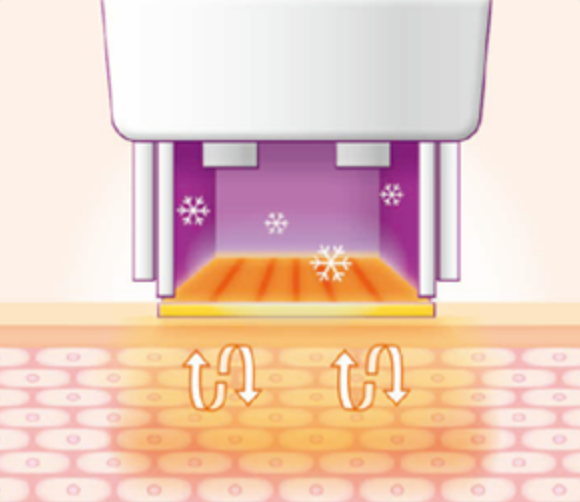 스킨 보톡스 시술 부위 설명 이미지 4