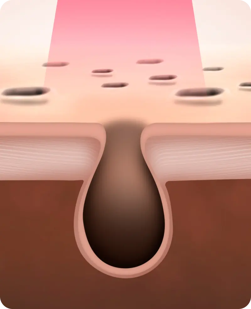 스킨 보톡스 시술 부위 설명 이미지 1