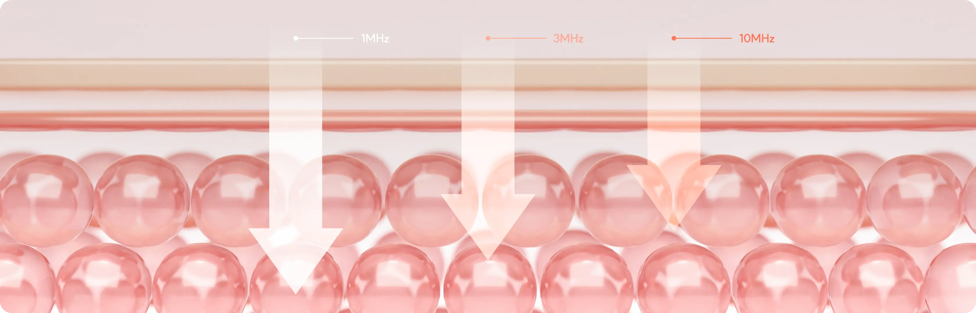 시술 설명 이미지 1