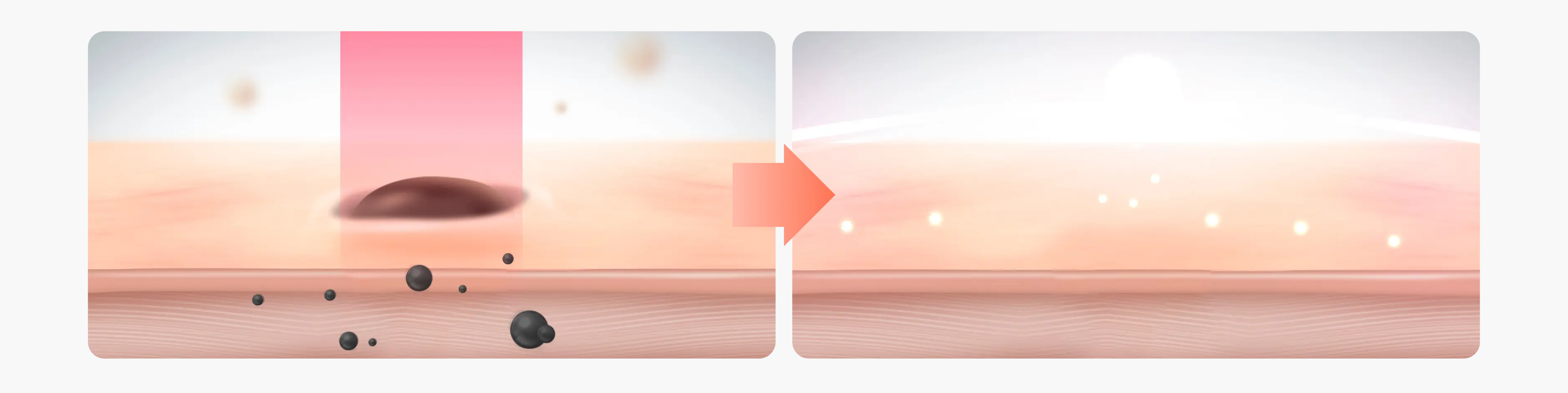 시술 설명 이미지 1